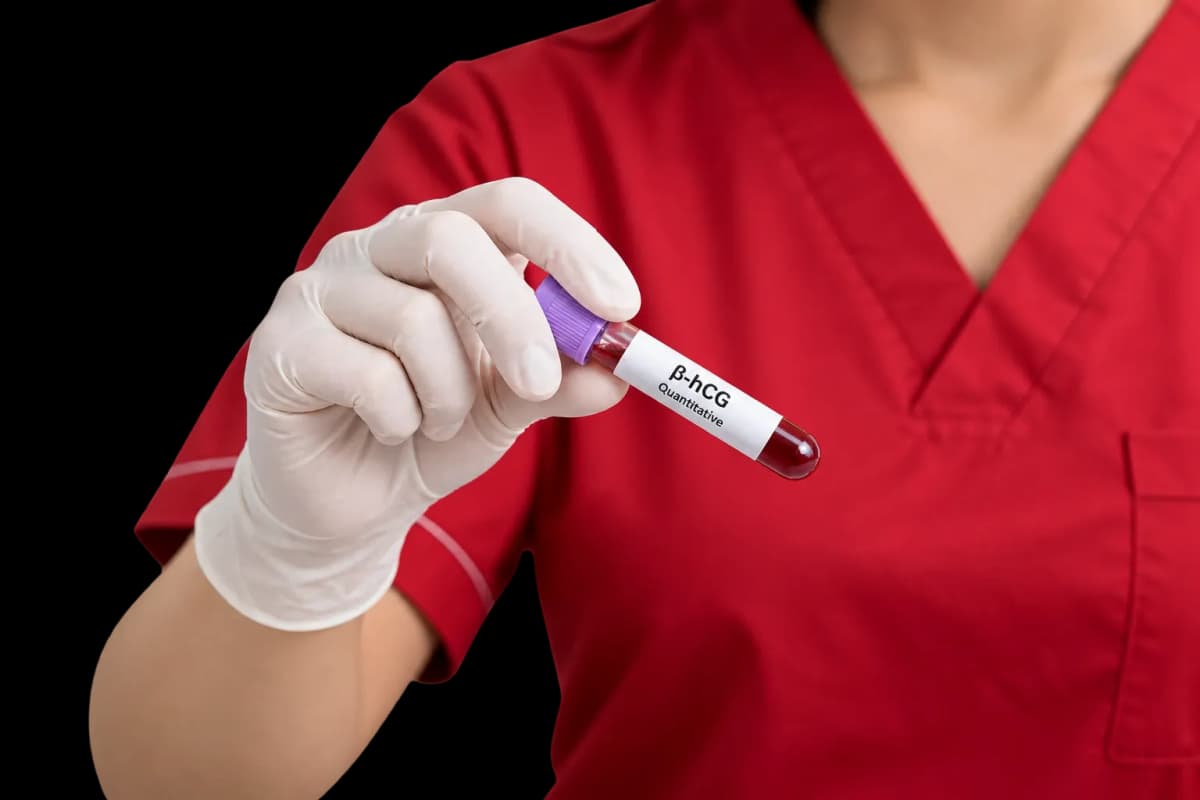 Beta hCG blood test for early pregnancy detection.