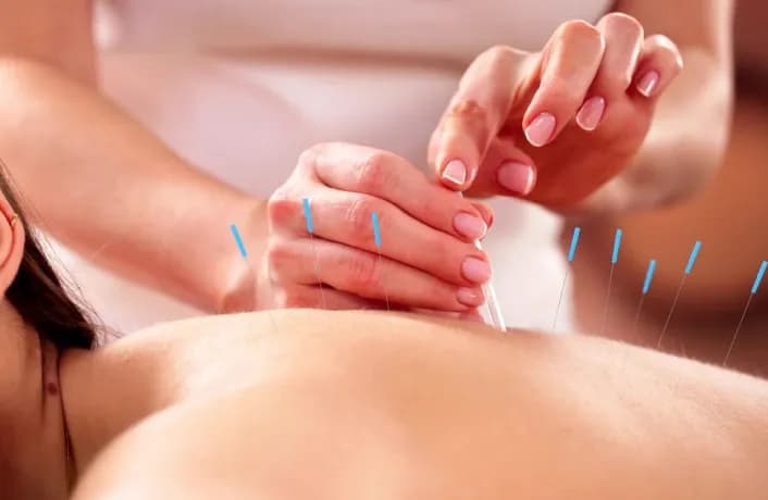 First Response Healthcare specialist administering an advanced dry needling session during an at-home physiotherapy visit in Dubai.