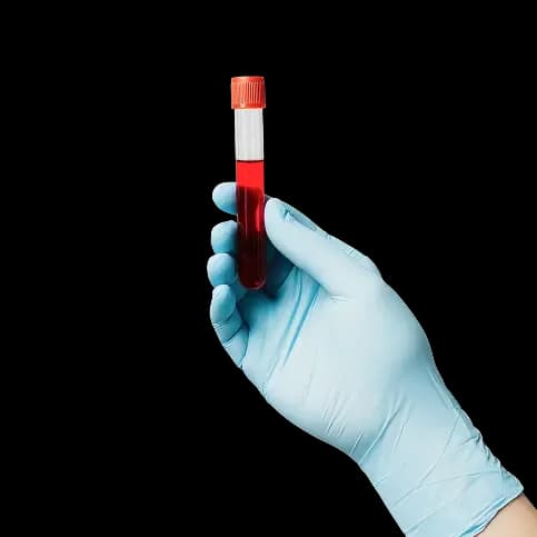 Lab Tests