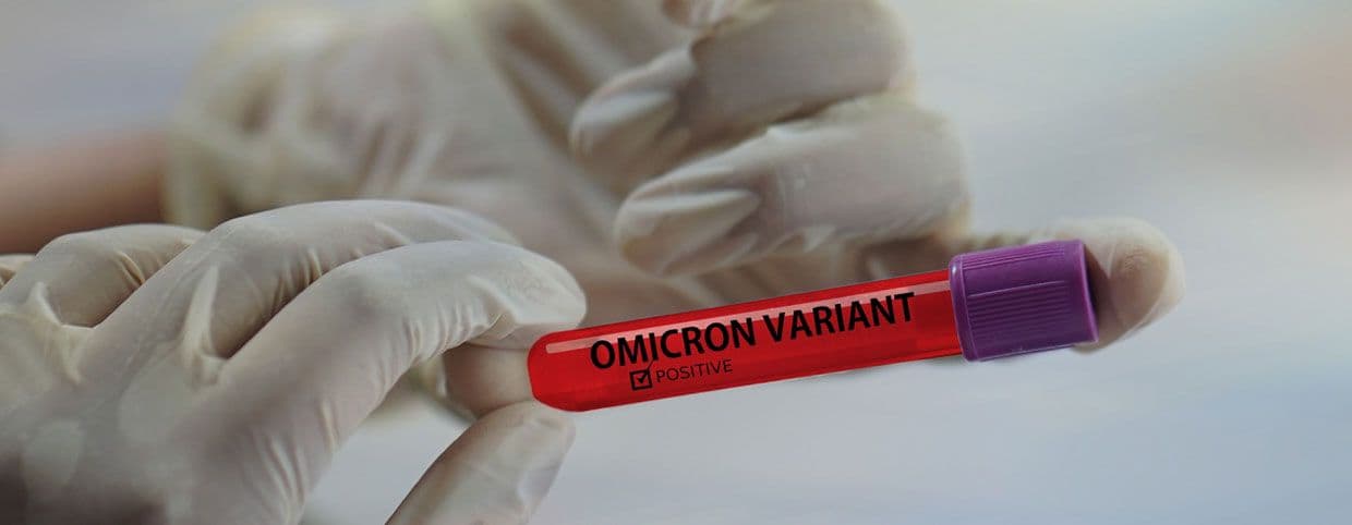 Omicron PCR Testing