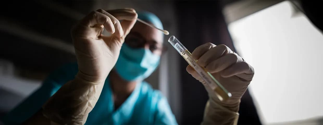متطلبات فحص PCR لكوفيد 19 من أجل السفر
