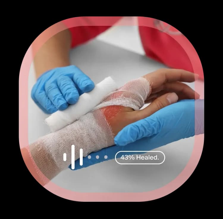 Proactive Recovery Monitoring