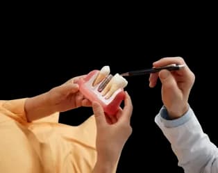 Fillings, Crowns & Root Canal Treatment