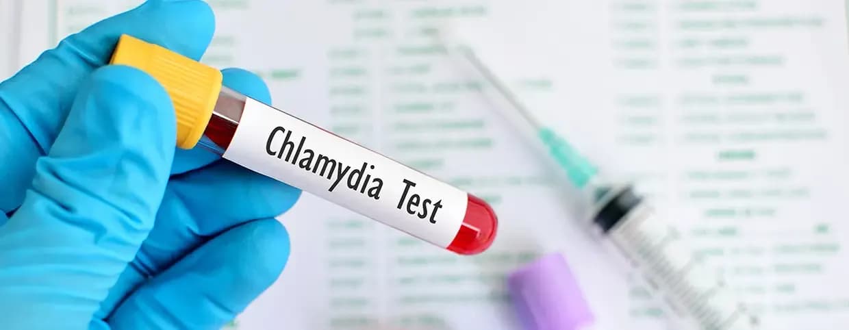 Chlamydia Testing: Why It’s Important and How It’s Done?