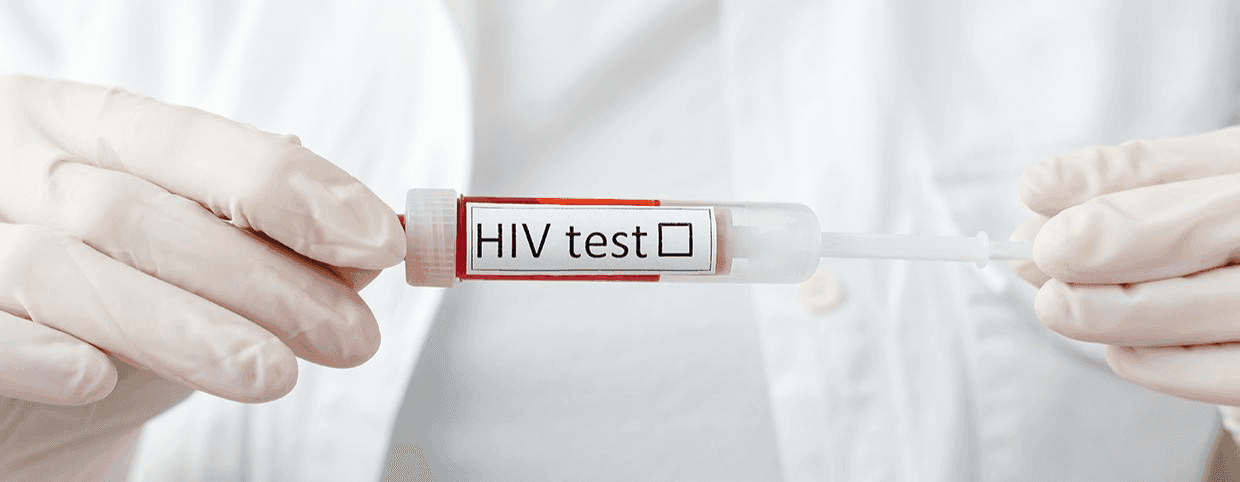 طرق انتقال فيروس نقص المناعة البشرية وأسبابه وأعراضه
