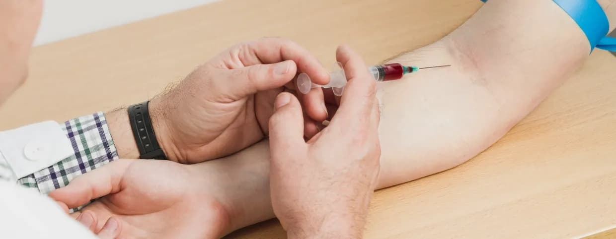 اختبار فيروس نقص المناعة البشرية في المنزل: كيف يعمل وما الذي يجب مراعاته؟