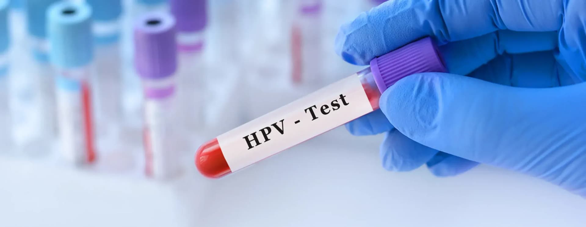 فهم فيروس الورم الحليمي البشري (HPV) – الحقائق الرئيسية حول الفيروس