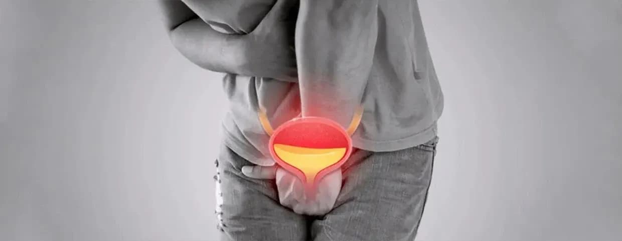 أعراض التهاب المسالك البولية عند الرجال
