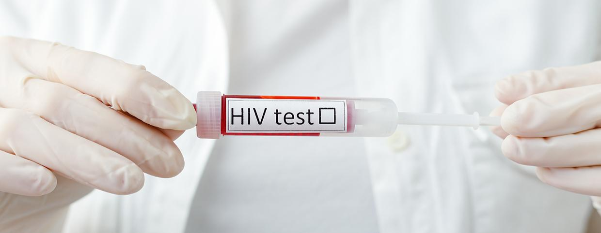 HIV Virus Transmission, Causes, and Symptoms to Know