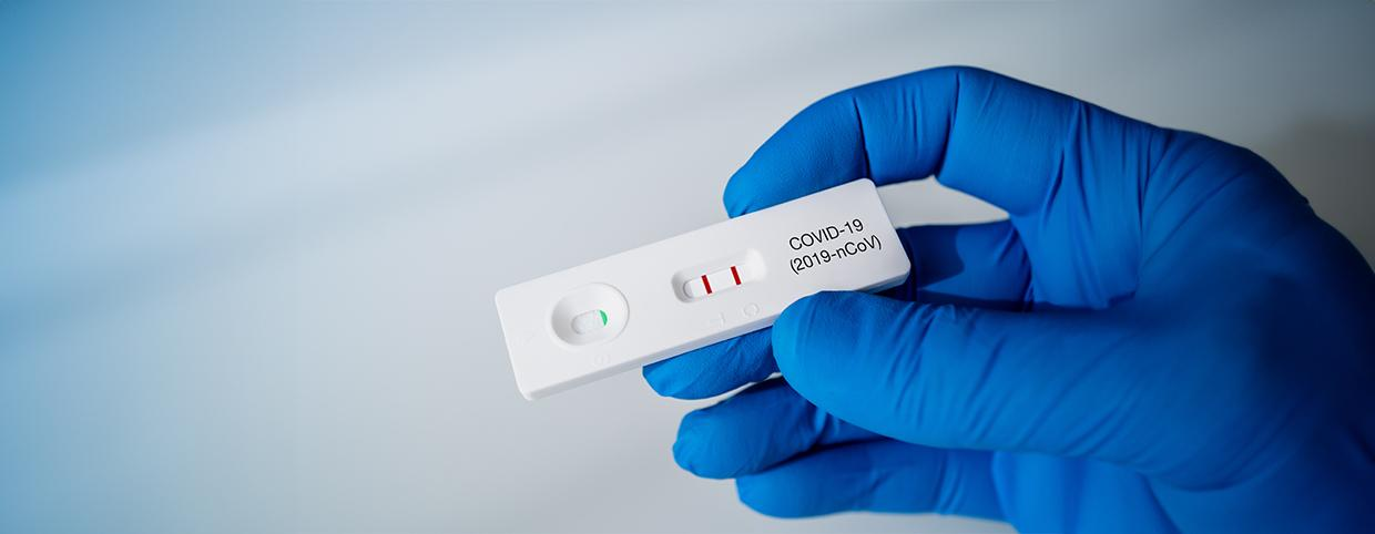 Unveiling the SARS-Linked Virus Insights and Implications of the Latest Case