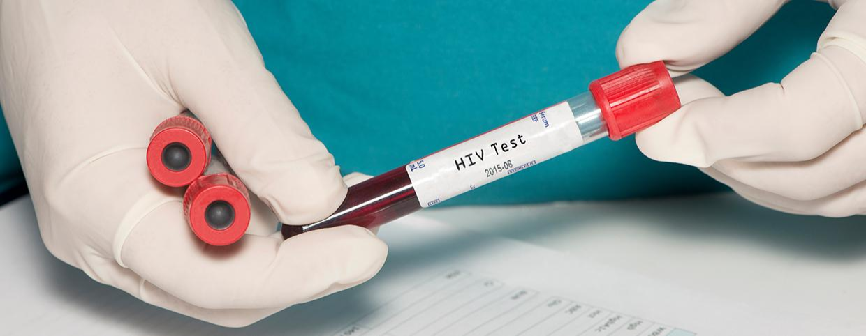 HIV Testing Types and Where to Get It Done?