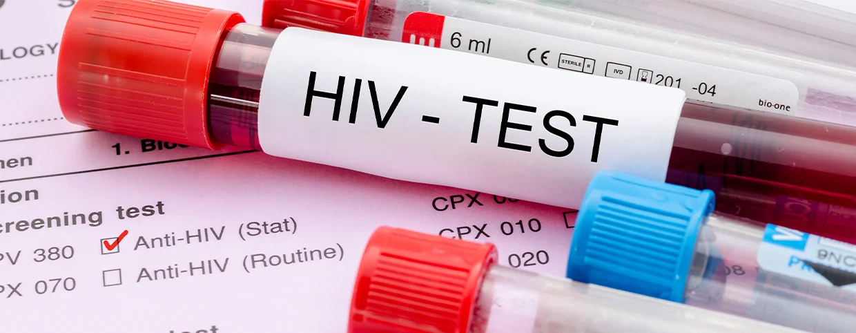 Early Signs of HIV: What Women and Men Should Look Out For