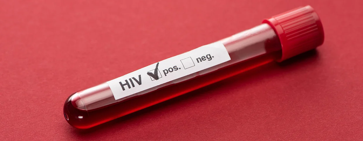 Understanding the Symptoms of HIV