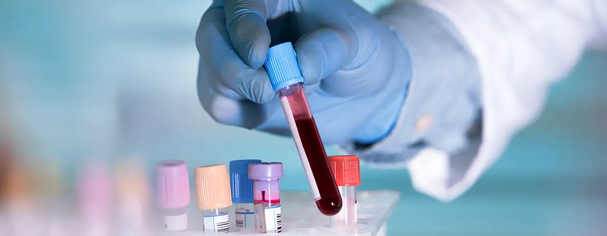 Common types of blood tests