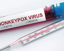 Image of thermometer and test tube labeled ‘Monkeypox Virus’