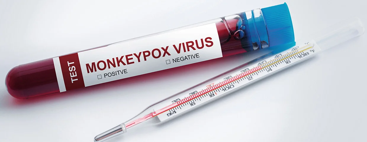 Image of thermometer and test tube labeled ‘Monkeypox Virus’