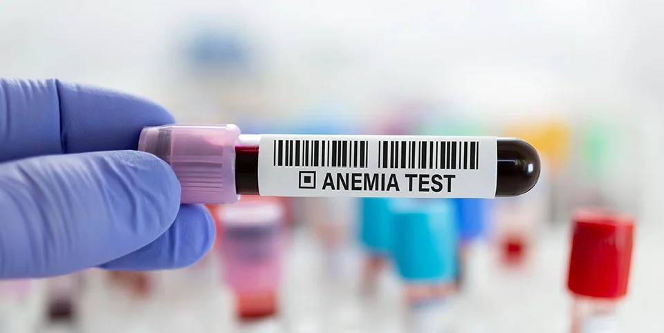 Test tube with blood sample for CBC test