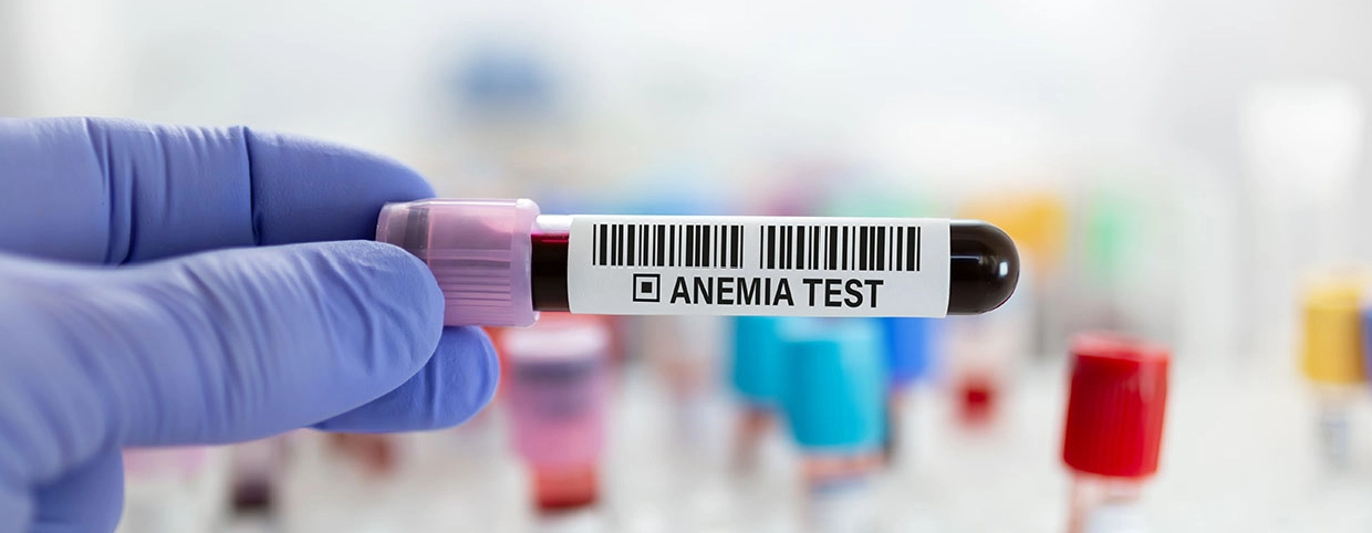 Test tube with blood sample for CBC test