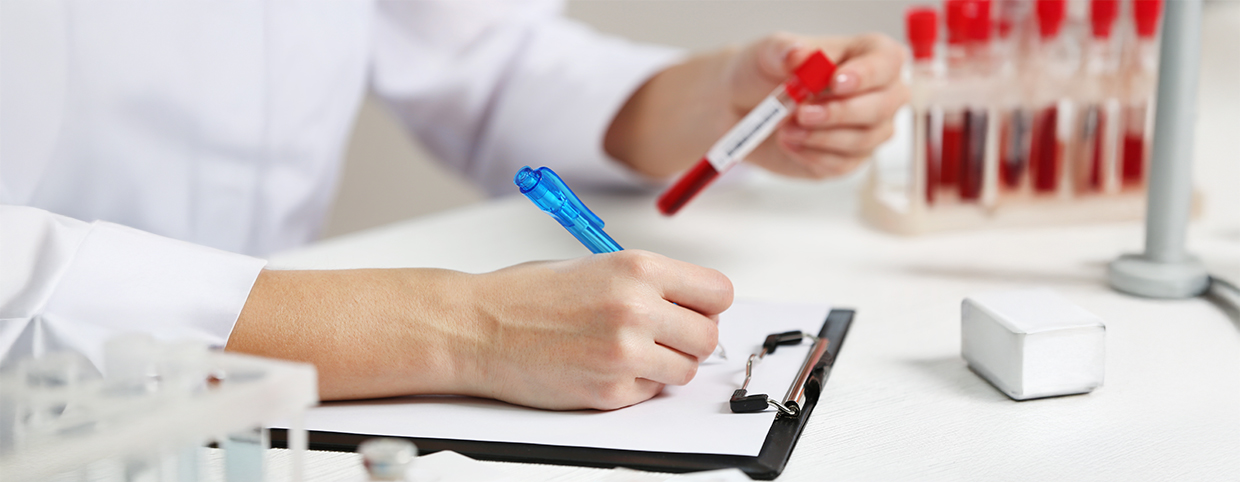 A doctor holding a test sample for CBC and filling in the details in the report