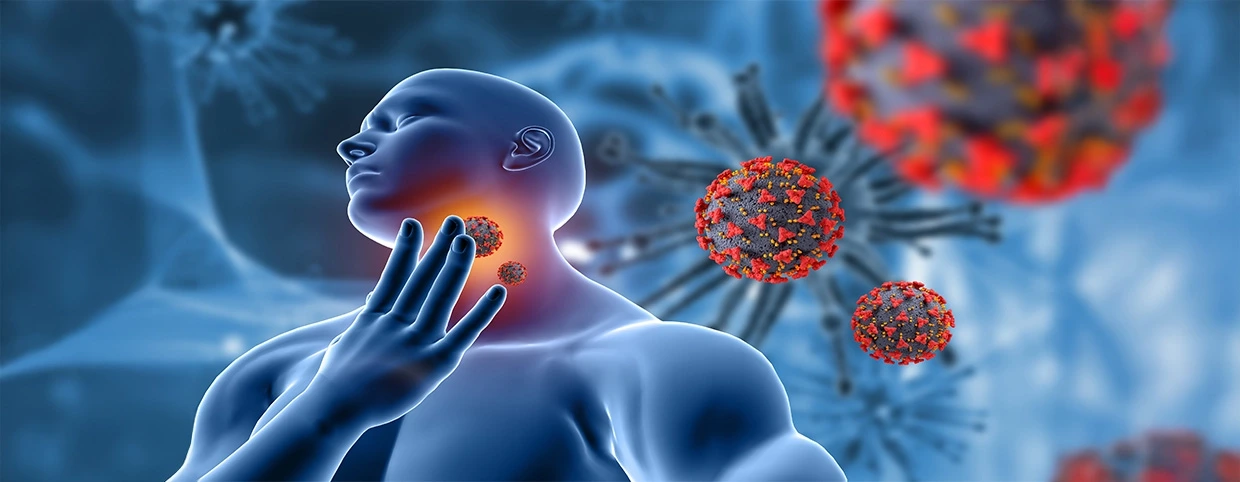 An illustration with a sore throat, likely due to tonsillitis