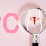 A magnifying glass highlighting a uterus illustration with the word PCOS in the background