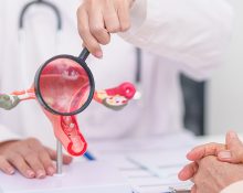 Doctor holding a uterus model with a magnifying glass highlighting PCOS