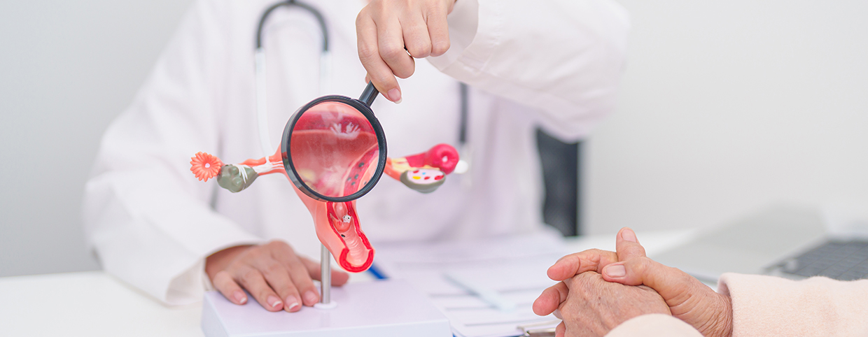 Doctor holding a uterus model with a magnifying glass highlighting PCOS